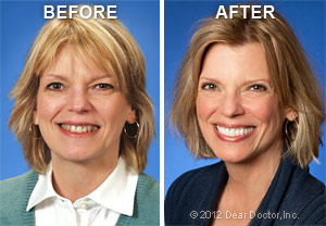 cosmetic-dentistry-before-after